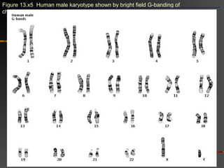 Figure 13.x5 Human male karyotype shown by bright field G-banding of
chromosomes
 