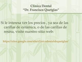 Clinica Dental
                 “Dr. Francisco Quetglas”



Si le interesa ver los precios , ya sea de las
  carillas de cerámica, o de las carillas de
  resina, visite nuestro sitio web:

 https://sites.google.com/site/clinicadentaldrquetglas/
 