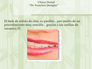 Clinica Dental
                 “Dr. Francisco Quetglas”




El look de artista de cine, es posible…por medio de un
procedimiento muy sencillo , gracias a las carillas de
ceramica !!!!
 