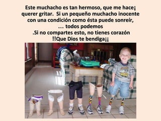Este muchacho es tan hermoso, que me hace¡
querer gritar. Si un pequeño muchacho inocente
con una condición como ésta puede sonreír,
… todos podemos
.Si no compartes esto, no tienes corazón
!!Que Dios te bendiga¡¡