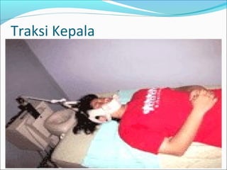 Traksi Kepala

 