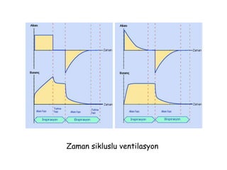 Zaman sikluslu ventilasyon
 
