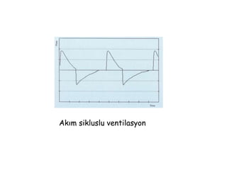 Akım sikluslu ventilasyon
 