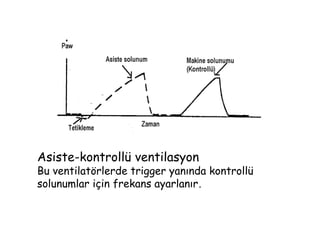 Asiste-kontrollü ventilasyon
Bu ventilatörlerde trigger yanında kontrollü
solunumlar için frekans ayarlanır.
 
