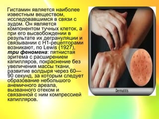 Гистамин является наиболее
известным веществом,
исследовавшимся в связи с
зудом. Он является
компонентом тучных клеток, а
при его высвобождении в
результате их дегрануляции и
связывании с Н1-рецепторами
возникают, по Lewis (1927),
три феномена: пятнистая
эритема с расширением
капилляров, покраснение без
увеличения массы ткани,
развитие волдыря через 60—
90 секунд, за которым следует
образование небольшого
анемичного ареала,
вызванного отеком и
связанной с ним компрессией
капилляров.
 
