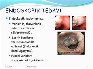 ENDOSKOPİK TEDAVİ
Endoskopik tedaviler ise;
 Varisin injeksiyonlarla
skleroze edilmesi
(Skleroterapi) ,
 Lastik bantlarla
varislerin eradike
edilmesi (Endoskopik
Band Ligasyonu),
Fundal varislere
siyanoakrilat injeksiyonu.
07.10.2017 M. İYİYÜREK 15
 