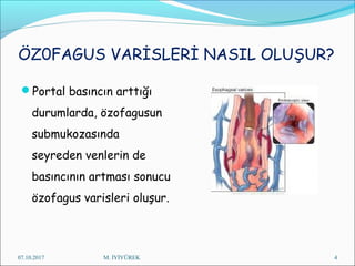 ÖZ0FAGUS VARİSLERİ NASIL OLUŞUR?
Portal basıncın arttığı
durumlarda, özofagusun
submukozasında
seyreden venlerin de
basıncının artması sonucu
özofagus varisleri oluşur.
07.10.2017 M. İYİYÜREK 4
 