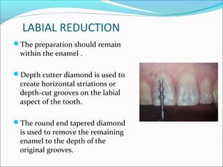 laminates | PPT