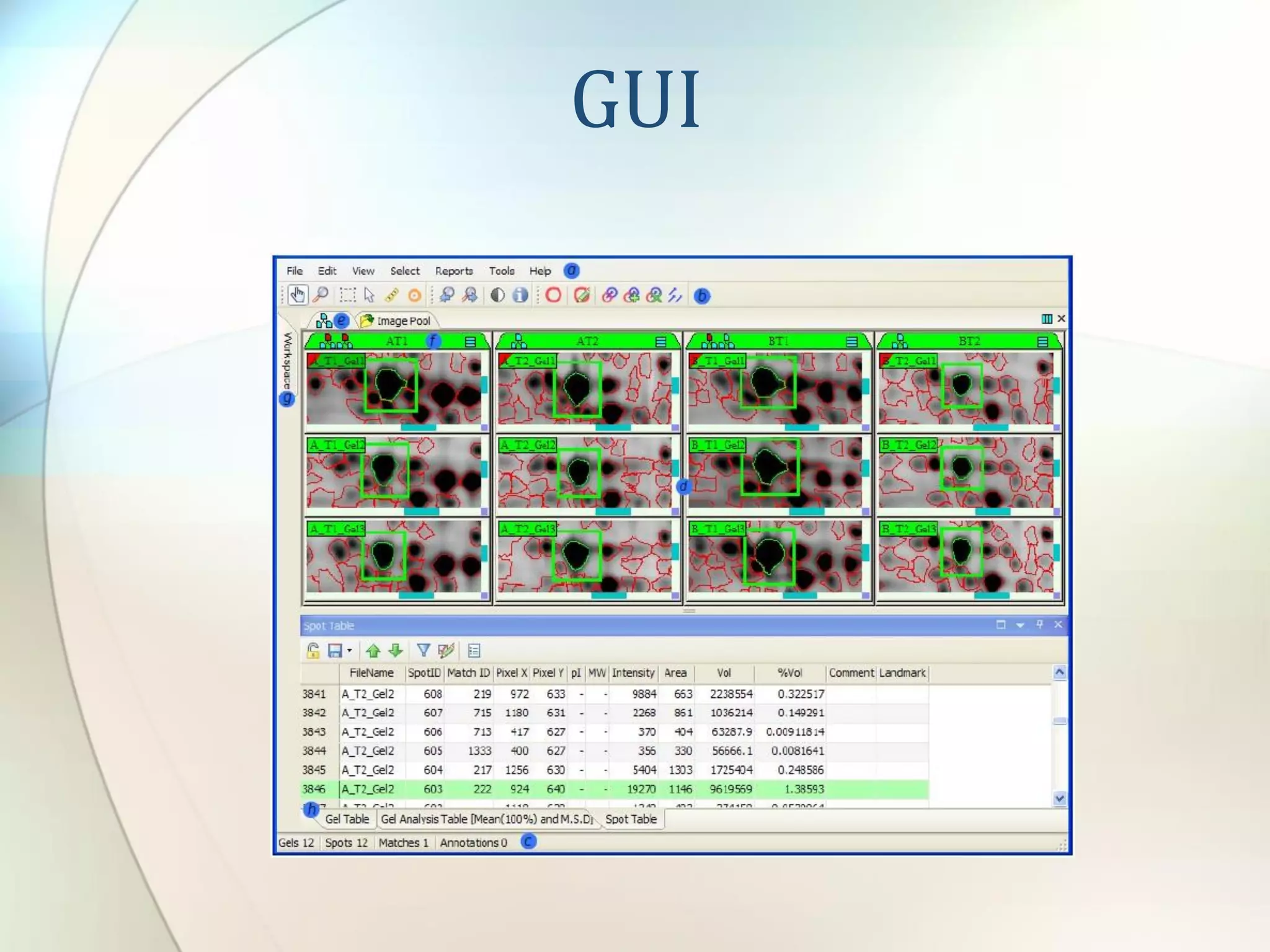 Melanie - 2D gel analysis software | PDF