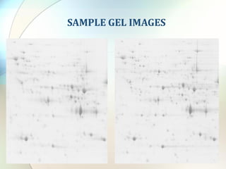 Melanie - 2D gel analysis software | PDF