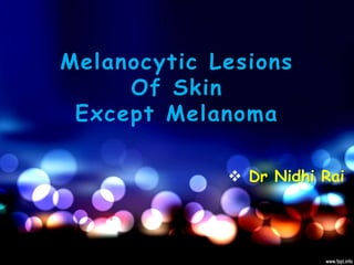 Melanocytic Lesions
Of Skin
Except Melanoma
 Dr Nidhi Rai
 