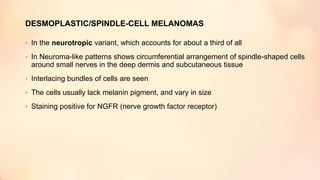 • In the neurotropic variant, which accounts for about a third of all
• In Neuroma-like patterns shows circumferential arrangement of spindle-shaped cells
around small nerves in the deep dermis and subcutaneous tissue
• Interlacing bundles of cells are seen
• The cells usually lack melanin pigment, and vary in size
• Staining positive for NGFR (nerve growth factor receptor)
DESMOPLASTIC/SPINDLE-CELL MELANOMAS
 