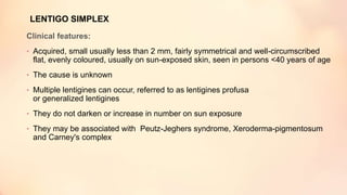 LENTIGO SIMPLEX
Clinical features:
• Acquired, small usually less than 2 mm, fairly symmetrical and well-circumscribed
flat, evenly coloured, usually on sun-exposed skin, seen in persons <40 years of age
• The cause is unknown
• Multiple lentigines can occur, referred to as lentigines profusa
or generalized lentigines
• They do not darken or increase in number on sun exposure
• They may be associated with Peutz-Jeghers syndrome, Xeroderma-pigmentosum
and Carney's complex
 
