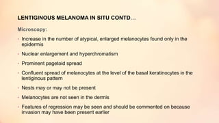 Microscopy:
• Increase in the number of atypical, enlarged melanocytes found only in the
epidermis
• Nuclear enlargement and hyperchromatism
• Prominent pagetoid spread
• Confluent spread of melanocytes at the level of the basal keratinocytes in the
lentiginous pattern
• Nests may or may not be present
• Melanocytes are not seen in the dermis
• Features of regression may be seen and should be commented on because
invasion may have been present earlier
LENTIGINOUS MELANOMA IN SITU CONTD…
 