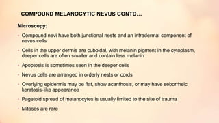 COMPOUND MELANOCYTIC NEVUS CONTD…
Microscopy:
• Compound nevi have both junctional nests and an intradermal component of
nevus cells
• Cells in the upper dermis are cuboidal, with melanin pigment in the cytoplasm,
deeper cells are often smaller and contain less melanin
• Apoptosis is sometimes seen in the deeper cells
• Nevus cells are arranged in orderly nests or cords
• Overlying epidermis may be flat, show acanthosis, or may have seborrheic
keratosis-like appearance
• Pagetoid spread of melanocytes is usually limited to the site of trauma
• Mitoses are rare
 