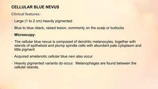 CELLULAR BLUE NEVUS
Clinical features:
• Large (1 to 2 cm) heavily pigmented
• Blue to blue–black, raised lesion, commonly on the scalp or buttocks
• Microscopy:
• The cellular blue nevus is composed of dendritic melanocytes, together with
islands of epithelioid and plump spindle cells with abundant pale cytoplasm and
little pigment
• Acquired amelanotic cellular blue nevi also occur
• Heavily pigmented variants do occur. Melanophages are found between the
cellular islands.
 