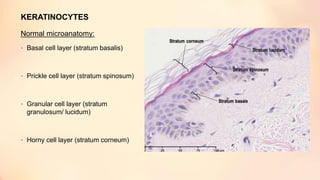 KERATINOCYTES
Normal microanatomy:
• Basal cell layer (stratum basalis)
• Prickle cell layer (stratum spinosum)
• Granular cell layer (stratum
granulosum/ lucidum)
• Horny cell layer (stratum corneum)
 