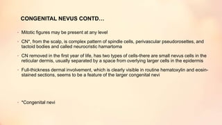 CONGENITAL NEVUS CONTD…
• Mitotic figures may be present at any level
• CN*, from the scalp, is complex pattern of spindle cells, perivascular pseudorosettes, and
tactoid bodies and called neurocristic hamartoma
• CN removed in the first year of life, has two types of cells-there are small nevus cells in the
reticular dermis, usually separated by a space from overlying larger cells in the epidermis
• Full-thickness dermal involvement, which is clearly visible in routine hematoxylin and eosin-
stained sections, seems to be a feature of the larger congenital nevi
• *Congenital nevi
 