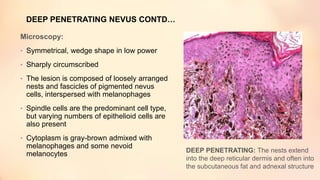 DEEP PENETRATING NEVUS CONTD…
Microscopy:
• Symmetrical, wedge shape in low power
• Sharply circumscribed
• The lesion is composed of loosely arranged
nests and fascicles of pigmented nevus
cells, interspersed with melanophages
• Spindle cells are the predominant cell type,
but varying numbers of epithelioid cells are
also present
• Cytoplasm is gray-brown admixed with
melanophages and some nevoid
melanocytes DEEP PENETRATING: The nests extend
into the deep reticular dermis and often into
the subcutaneous fat and adnexal structure
 