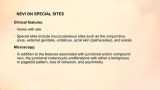 NEVI ON SPECIAL SITES
Clinical features:
• Varies with site
• Special sites include mucocutaneous sites such as the conjunctiva,
anus, external genitalia, umbilicus, acral skin (palms/soles), and areola
Microscopy:
• In addition to the features associated with junctional and/or compound
nevi, the junctional melanocytic proliferations with either a lentiginous
or pagetoid pattern, loss of cohesion, and asymmetry
 