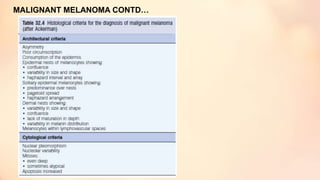 MALIGNANT MELANOMA CONTD…
 