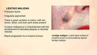 LENTIGO MALIGNA
• Precursor lesion
• Irregularly pigmented
• There is great variation in colour, with tan-
brown, black, and even pink areas present
• Invasive malignancy is characterized with the
development of elevated plaques or discrete
nodules
• Rapid progression to a invasive tumour Lentigo maligna: a dark black nodule of
invasive tumor is surrounded by typical
lentigo maligna.
 