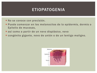 ETIOPATOGENIA
 No se conoce con precisión.
 Puede comenzar en los melanocitos de la epidermis, dermis o
Epitelio de mucosas,
 así como a partir de un nevo displásico, nevo
 congénito gigante, nevo de unión o de un lentigo maligno.

 
