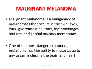 MALIGNANT MELANOMA
• Malignant melanoma is a malignancy of
melanocytes that occurs in the skin, eyes,
ears, gastrointestinal tract, leptomeninges,
and oral and genital mucous membranes.
• One of the most dangerous tumors,
melanoma has the ability to metastasize to
any organ, including the brain and heart.
Ihab Samy 2014
 