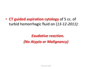 • CT guided aspiration cytology of 5 cc. of
turbid hemorrhagic fluid on (13-12-2011):
Exudative reaction.
(No Atypia or Malignancy)
Ihab Samy 2014
 