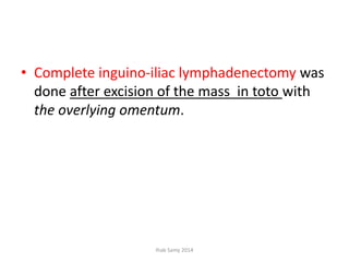 • Complete inguino-iliac lymphadenectomy was
done after excision of the mass in toto with
the overlying omentum.
Ihab Samy 2014
 