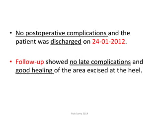 • No postoperative complications and the
patient was discharged on 24-01-2012.
• Follow-up showed no late complications and
good healing of the area excised at the heel.
Ihab Samy 2014
 