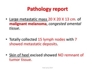 Pathology report
• Large metastatic mass 20 X 20 X 13 cm. of
malignant melanoma, congested omental
tissue.
• Totally collected 15 lymph nodes with 7
showed metastatic deposits.
• Skin of heel excised showed NO remnant of
tumor tissue.
Ihab Samy 2014
 