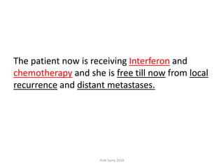 The patient now is receiving Interferon and
chemotherapy and she is free till now from local
recurrence and distant metastases.
Ihab Samy 2014
 