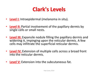 Clark's Levels
• Level I: Intraepidermal (melanoma in situ).
• Level II: Partial involvement of the papillary dermis by
single cells or small nests.
• Level III: Expansile nodule filling the papillary dermis and
widening it, impinging upon the reticular dermis. A few
cells may infiltrate the superficial reticular dermis.
• Level IV: Extension of multiple cells across a broad front
into the reticular dermis.
• Level V: Extension into the subcutaneous fat.
Ihab Samy 2014
 