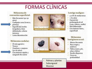 FORMAS CLÍNICAS
- Palmas y plantas
- Subungueal
- Mucoso
 