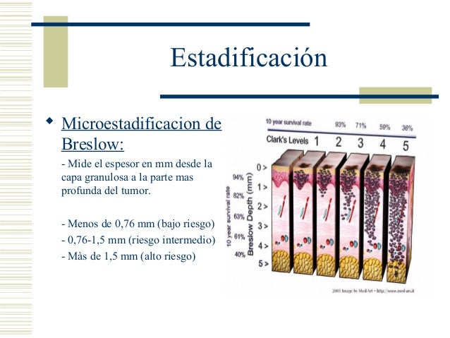 Clark And Breslow Scale _ breslow/clark scale – NTBA