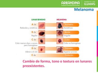 Melanoma
Cambio de forma, tono o textura en lunares
preexistentes.
 