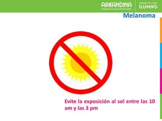 Evite la exposición al sol entre las 10
am y las 3 pm
Melanoma
 