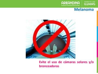 Melanoma
Evite el uso de cámaras solares y/o
bronceadoras
 
