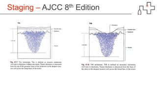 Staging – AJCC 8th Edition
 