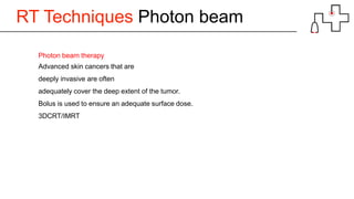 RT Techniques Photon beam
Photon beam therapy
Advanced skin cancers that are
deeply invasive are often
adequately cover the deep extent of the tumor.
Bolus is used to ensure an adequate surface dose.
3DCRT/IMRT
 