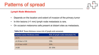 Patterns of spread
Lymph Node Metastasis
• Depends on the location and extent of invasion of the primary tumor
• In thin lesions (<1 mm) lymph node metastasis is rare.
• On occasion melanoma cells present at distant sites as metastasis.
 