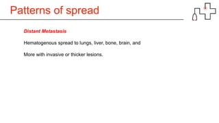 Patterns of spread
Distant Metastasis
Hematogenous spread to lungs, liver, bone, brain, and
More with invasive or thicker lesions.
 