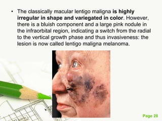 Melanoma (malignant melanoma)