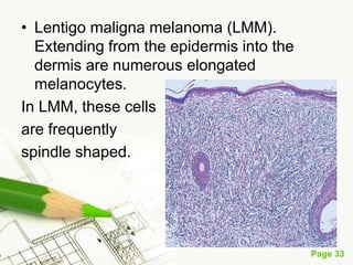 Melanoma (malignant melanoma)