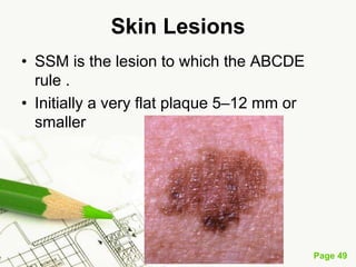 Melanoma (malignant melanoma)