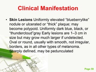 Melanoma (malignant melanoma)
