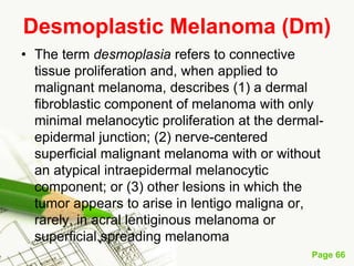 Melanoma (malignant melanoma)