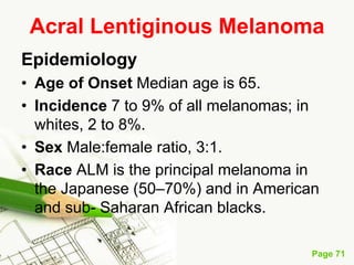 Melanoma (malignant melanoma)