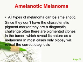 Melanoma (malignant melanoma)